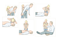 Resuscitation Advice for the young.  (Gallery 27)